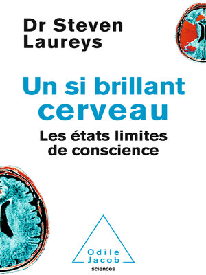 cover image of Un si brillant cerveau